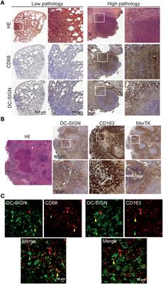 The C-Type Lectin Receptor DC-SIGN Has an Anti-Inflammatory Role in Human M(IL-4) Macrophages in Response to Mycobacterium tuberculosis